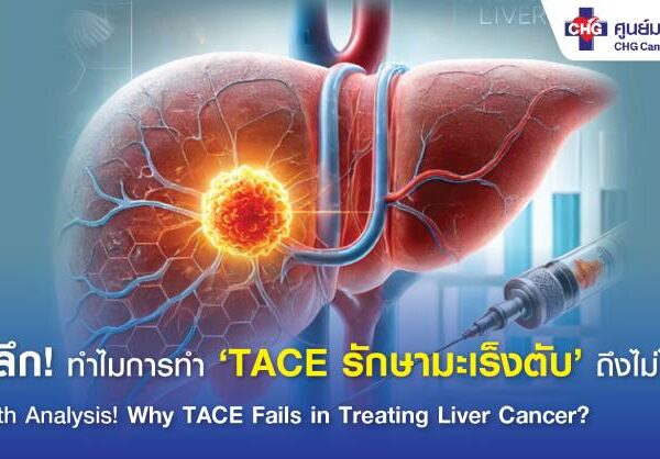 ทำไมการทำ TACE รักษามะเร็งตับถึงไม่ได้ผล?