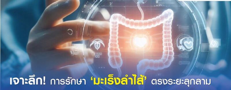 ภาพประกอบทางการแพทย์ของตัวเลือกการรักษามะเร็งช่องทวารหนักขั้นสูง แสดงช่องทวารหนักที่มีการเจริญเติบโตของมะเร็ง เน้นการผ่าตัด เคมีบำบัด รังสีบำบัด การบำบัดแบบกำหนดเป้าหมาย และการบำบัดด้วยภูมิคุ้มกัน