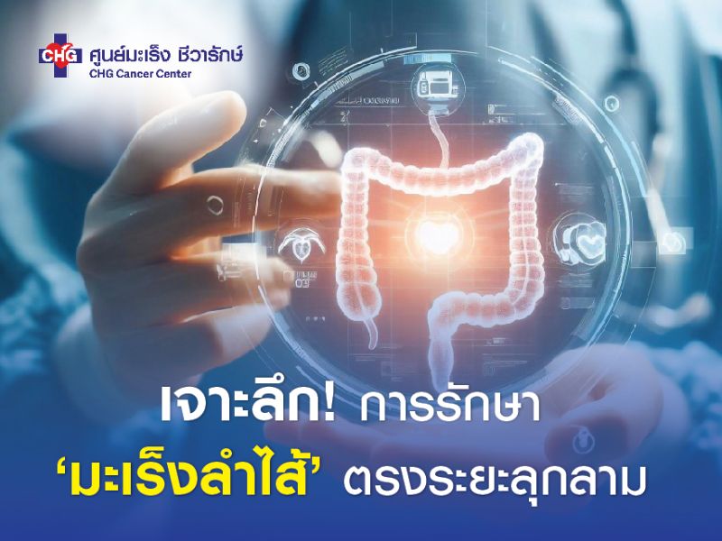 ภาพประกอบทางการแพทย์ของตัวเลือกการรักษามะเร็งช่องทวารหนักขั้นสูง แสดงช่องทวารหนักที่มีการเจริญเติบโตของมะเร็ง เน้นการผ่าตัด เคมีบำบัด รังสีบำบัด การบำบัดแบบกำหนดเป้าหมาย และการบำบัดด้วยภูมิคุ้มกัน