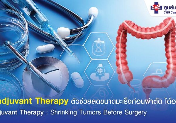 Neoadjuvant Therapy ลดขนาดมะเร็งก่อนผ่าตัด