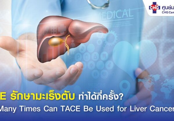 TACE รักษามะเร็งตับ ทำได้กี่ครั้ง?