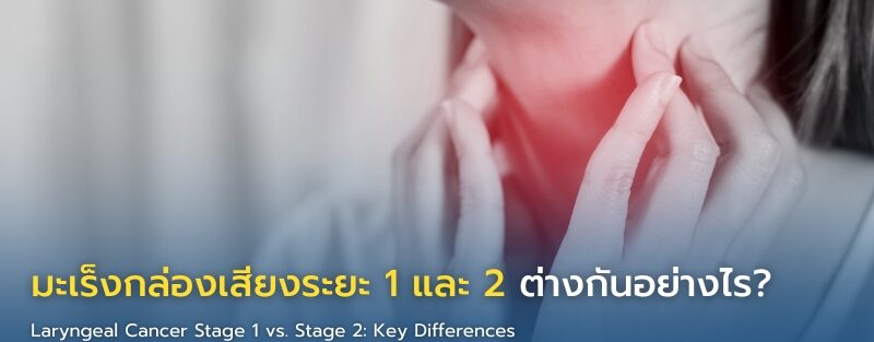 ภาพแสดงความแตกต่างระหว่างมะเร็งกล่องเสียงระยะที่ 1 และระยะที่ 2 โดยเปรียบเทียบขนาดก้อนมะเร็งและการลุกลามในกล่องเสียง