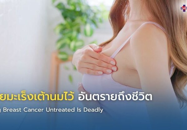 ปล่อยมะเร็งเต้านมไว้ อันตรายถึงชีวิต