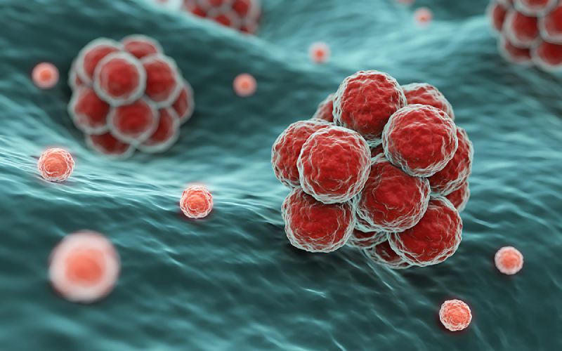 อินโฟกราฟิกแสดงแนวทางการรักษามะเร็งแพร่กระจายในวงจำกัด เช่น ผ่าตัด ฉายแสง และยาเฉพาะทาง พร้อมภาพร่างกายมนุษย์และจุดมะเร็ง