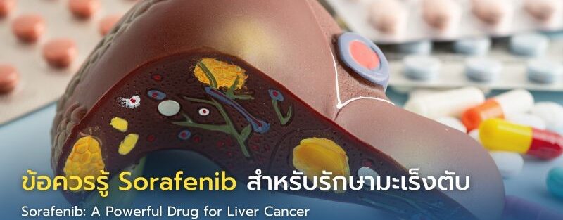 อินโฟกราฟิกอธิบายข้อควรรู้เกี่ยวกับยา Sorafenib สำหรับรักษามะเร็งตับ รวมประโยชน์ ผลข้างเคียง และแนวทางใช้อย่างปลอดภัย