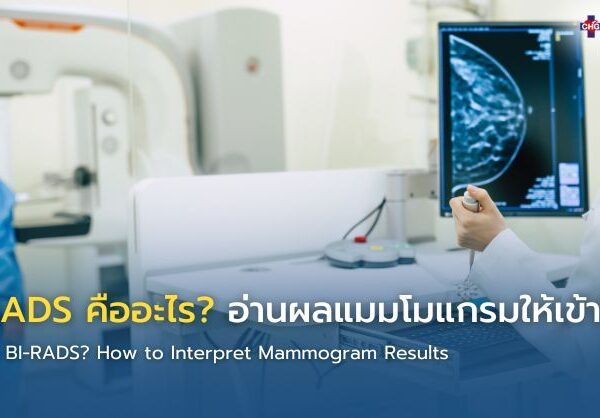 BI-RADS คืออะไร อ่านผลแมมโมแกรมให้เข้าใจ