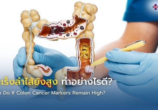 ค่ามะเร็งลำไส้ยังสูง ทำอย่างไรดี?