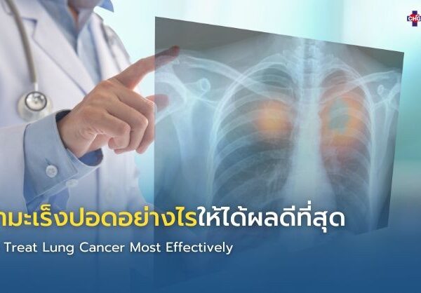 รักษามะเร็งปอดอย่างไรให้ได้ผลดีที่สุด