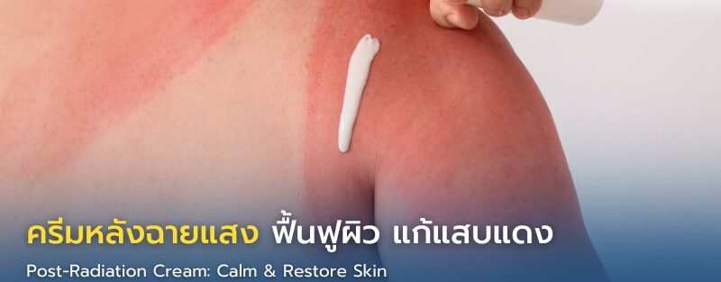 ผู้ป่วยมะเร็งทาครีมบำรุงผิวหลังฉายแสง ช่วยลดอาการแสบแดงและฟื้นฟูผิวอย่างอ่อนโยน