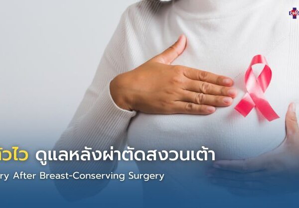 ฟื้นตัวไว ดูแลหลังผ่าตัดสงวนเต้า