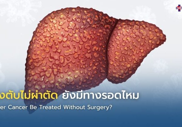 มะเร็งตับไม่ผ่าตัด ยังมีทางรอดไหม