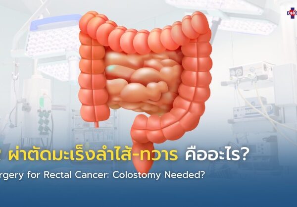 APR ผ่าตัดมะเร็งลำไส้-ทวาร คืออะไร?