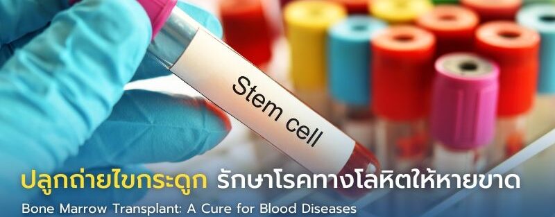 อินโฟกราฟิกแสดงกระบวนการปลูกถ่ายไขกระดูกเพื่อรักษาโรคเลือด เช่น มะเร็งเม็ดเลือดขาว และมะเร็งต่อมน้ำเหลือง