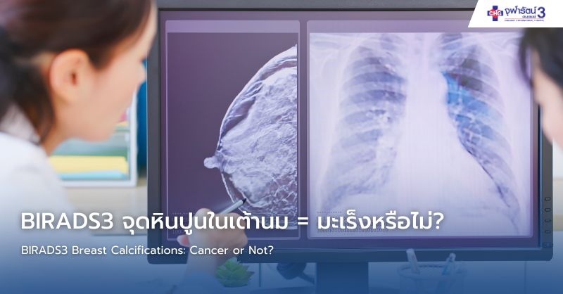 Infographic อธิบาย Precision Oncology การรักษามะเร็งเต้านมแบบแม่นยำ ด้วยการตรวจยีนหลายยีน เลือกยาตรงจุด ลดโอกาสกลับมาเป็นซ้ำ