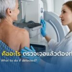 BIRADS 3 คืออะไร ตรวจเจอแล้วต้องทำอย่างไร