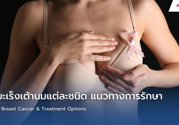 รู้จักมะเร็งเต้านมแต่ละชนิด แนวทางการรักษา