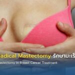 Modified Radical Mastectomy รักษามะเร็งเต้านม