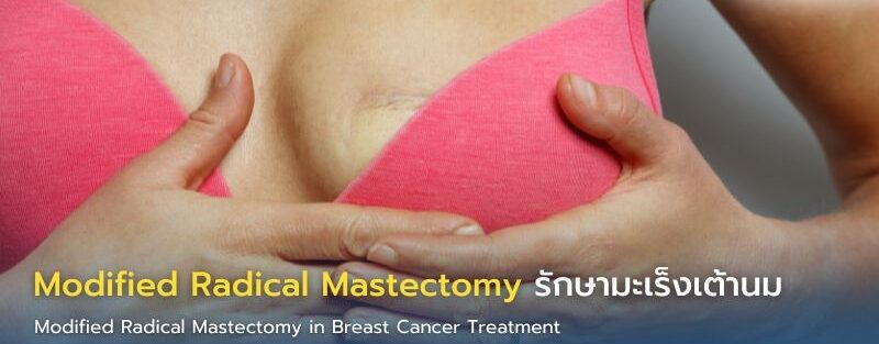 อินโฟกราฟิกหัวข้อ Modified Radical Mastectomy in Breast Cancer Treatment แสดงภาพเต้านมพร้อมริบบิ้นชมพู การเลาะต่อมน้ำเหลือง และข้อความอธิบายว่า MRM คืออะไร เมื่อใดควรทำ และข้อดี เช่น ลดโอกาสกลับเป็นซ้ำ เก็บกล้ามเนื้อหน้าอก ฟื้นตัวเร็ว