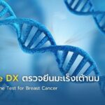 Oncotype DX ตรวจยีนมะเร็งเต้านม