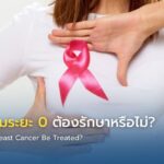 มะเร็งเต้านมระยะ 0 ต้องรักษาหรือไม่?