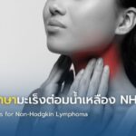 แนวทางรักษามะเร็งต่อมน้ำเหลือง NHL