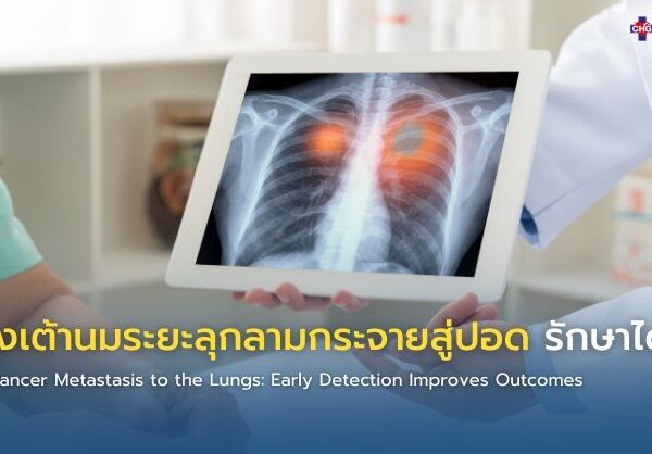 มะเร็งเต้านมระยะลุกลามกระจายสู่ปอด รักษาได้