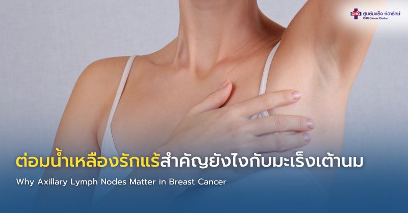 ภาพแสดงตำแหน่งต่อมน้ำเหลืองรักแร้และความสำคัญในการประเมินการกระจายของมะเร็งเต้านมและการวางแผนการรักษา