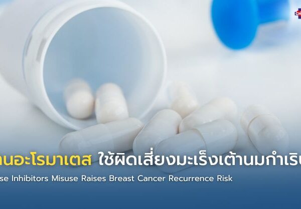 ยาต้านอะโรมาเตส ใช้ผิดเสี่ยงมะเร็งเต้านมกำเริบ