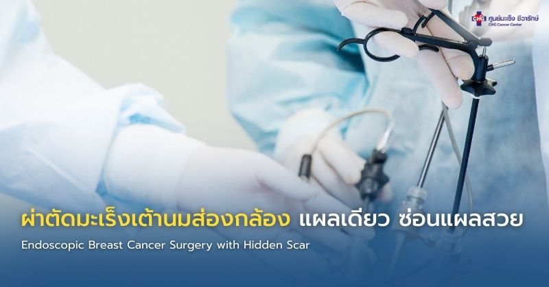 ภาพอินโฟกราฟิกแสดงการผ่าตัดมะเร็งเต้านมแบบส่องกล้องผ่านแผลเดียวทางรักแร้ ร่วมกับ Sentinel Node Biopsy เพื่อซ่อนแผลและลดการบาดเจ็บ