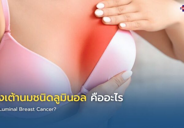 มะเร็งเต้านมชนิดลูมินอล คืออะไร