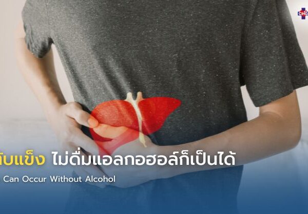 โรคตับแข็ง ไม่ดื่มแอลกอฮอล์ก็เป็นได้