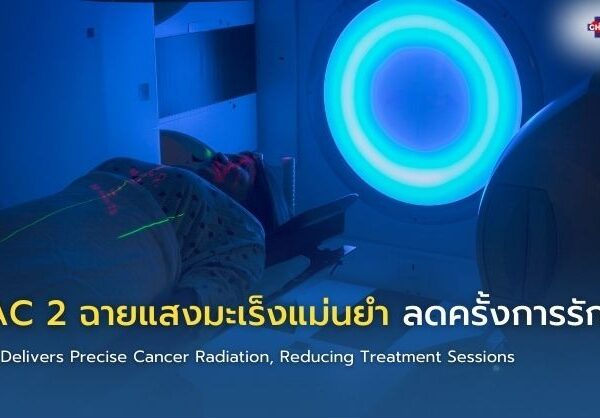 LINAC 2 ฉายแสงมะเร็งแม่นยำ ลดครั้งการรักษา