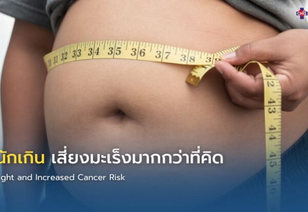 ภาพแสดงไขมันสะสมในร่างกายที่อาจเพิ่มความเสี่ยงโรคมะเร็ง