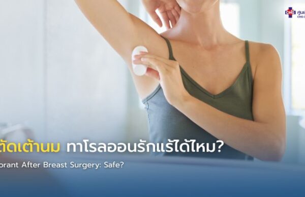 ภาพอินโฟกราฟิกแสดงผู้ป่วยหลังผ่าตัดเต้านมมีแผลหายดี และโรลออนใต้วงแขน สื่อถึงคำแนะนำการใช้โรลออนอย่างปลอดภัยหลังผ่าตัดและการป้องกันแขนบวม