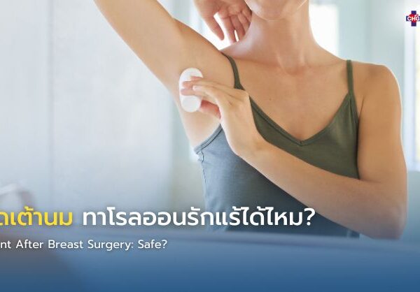 ผ่าตัดเต้านม ทาโรลออนรักแร้ได้ไหม?