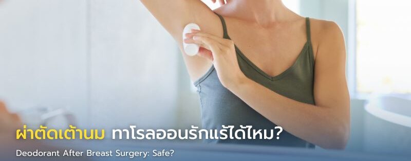 ภาพอินโฟกราฟิกแสดงผู้ป่วยหลังผ่าตัดเต้านมมีแผลหายดี และโรลออนใต้วงแขน สื่อถึงคำแนะนำการใช้โรลออนอย่างปลอดภัยหลังผ่าตัดและการป้องกันแขนบวม