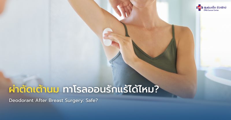 ภาพอินโฟกราฟิกแสดงผู้ป่วยหลังผ่าตัดเต้านมมีแผลหายดี และโรลออนใต้วงแขน สื่อถึงคำแนะนำการใช้โรลออนอย่างปลอดภัยหลังผ่าตัดและการป้องกันแขนบวม