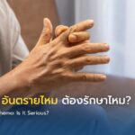 ชาหลังคีโม อันตรายไหม ต้องรักษาไหม?