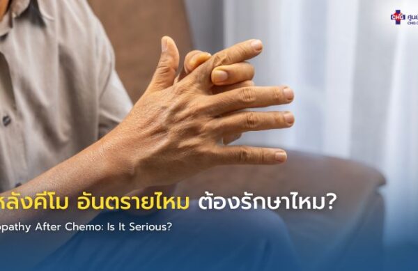 ภาพอินโฟกราฟิกแสดงผู้ป่วยหลังคีโมมีอาการชาปลายมือ พร้อมข้อมูลอธิบายผลข้างเคียงเส้นประสาทส่วนปลายอักเสบและคำแนะนำการดูแลตัวเองหลังเคมีบำบัด