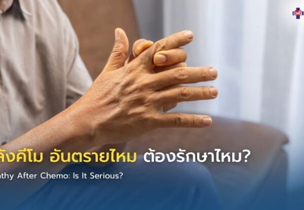 ภาพอินโฟกราฟิกแสดงผู้ป่วยหลังคีโมมีอาการชาปลายมือ พร้อมข้อมูลอธิบายผลข้างเคียงเส้นประสาทส่วนปลายอักเสบและคำแนะนำการดูแลตัวเองหลังเคมีบำบัด