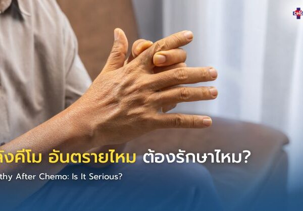 ชาหลังคีโม อันตรายไหม ต้องรักษาไหม?