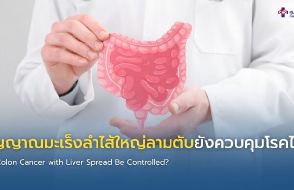 อินโฟกราฟิกแสดงสัญญาณที่บ่งชี้ว่ามะเร็งลำไส้ใหญ่ที่มีการแพร่กระจายไปยังตับอยู่ภายใต้การควบคุม รวมถึงการหดตัวของเนื้องอก ระดับ CEA ที่คงที่ การทำงานของตับที่ดี และการตอบสนองต่อการรักษาในเชิงบวก