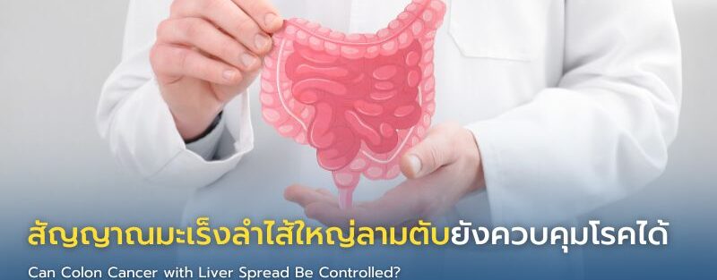 อินโฟกราฟิกแสดงสัญญาณที่บ่งชี้ว่ามะเร็งลำไส้ใหญ่ที่มีการแพร่กระจายไปยังตับอยู่ภายใต้การควบคุม รวมถึงการหดตัวของเนื้องอก ระดับ CEA ที่คงที่ การทำงานของตับที่ดี และการตอบสนองต่อการรักษาในเชิงบวก