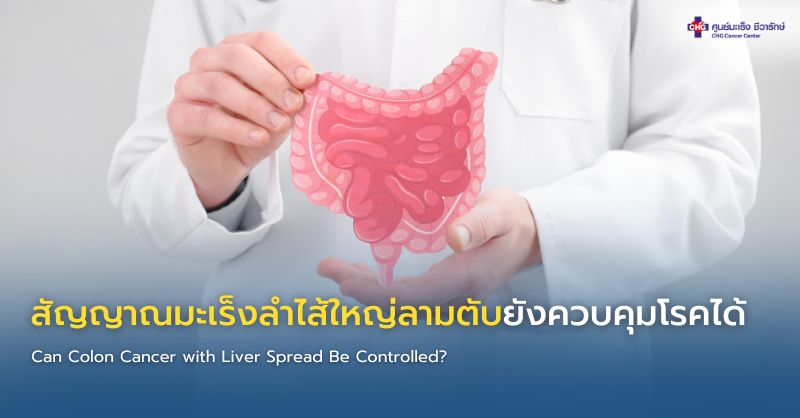 อินโฟกราฟิกแสดงสัญญาณที่บ่งชี้ว่ามะเร็งลำไส้ใหญ่ที่มีการแพร่กระจายไปยังตับอยู่ภายใต้การควบคุม รวมถึงการหดตัวของเนื้องอก ระดับ CEA ที่คงที่ การทำงานของตับที่ดี และการตอบสนองต่อการรักษาในเชิงบวก