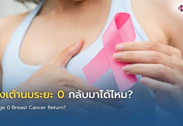 ภาพอินโฟกราฟิกแสดงการตรวจเต้านมและการติดตามหลังรักษามะเร็งเต้านมระยะเริ่มต้น พร้อมข้อมูลความเสี่ยงการกลับมาเป็นซ้ำและวิธีป้องกัน