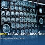 Glioblastoma มะเร็งสมองรุนแรงที่ควรรู้