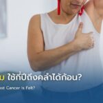 มะเร็งเต้านม ใช้กี่ปีถึงคลำได้ก้อน?