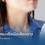 เช็ก 7 อาการมะเร็งเม็ดเลือดขาว