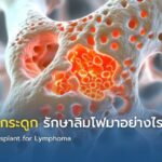 ปลูกถ่ายไขกระดูก รักษาลิมโฟมาอย่างไร?