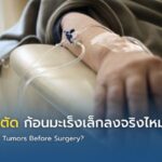 คีโมก่อนผ่าตัด ก้อนมะเร็งเล็กลงจริงไหม?